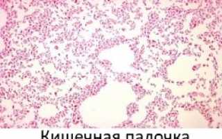 Клеточное строение характерно для кишечной палочки