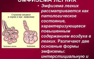 Эмфизема: причины болезни, симптомы и все средства лечения