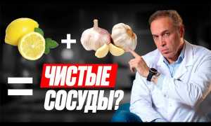 Как чистить сосуды сердца от бляшек: народные средства — 7 проверенных рецептов